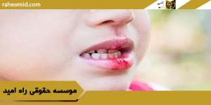 نرخ دیه دندان در قانون